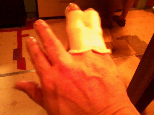 Lisa Hitz's album, lisa's rt hand 11-28-12