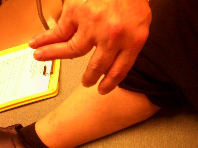 Lisa Hitz's album, lisa's rt hand 11-28-12