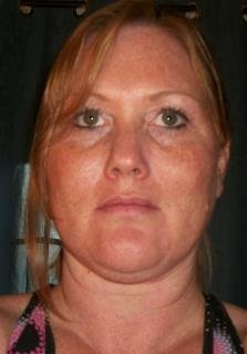 Lora Kuhnwald's album, Lora