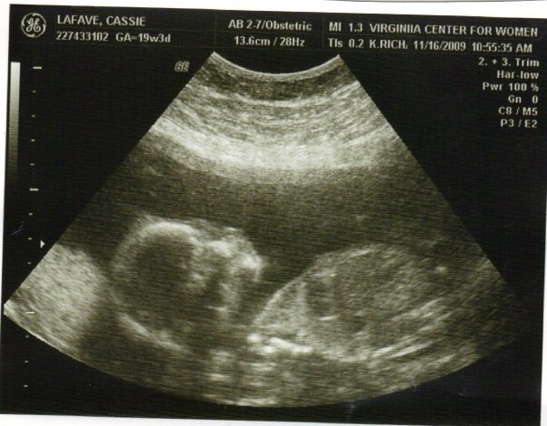 Cindy Alieni's album, THE NEW BABY