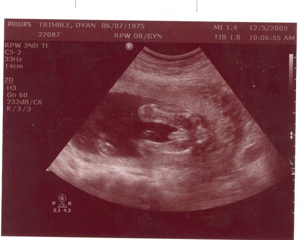 Dyan Trimble's album, Baby Trimble