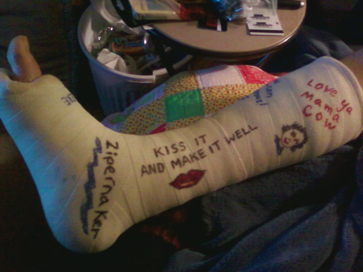 Curtis Springer's album, November, 12th 2010 Broken Ankle