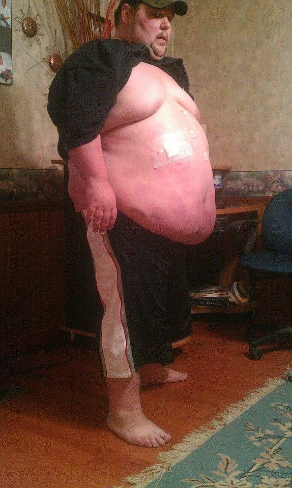 Bruce Anglin's album, weight loss journey