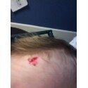 Kim Ellis' album, Nathan's "owie"