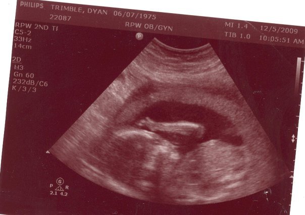 Dyan Trimble's album, Baby Trimble