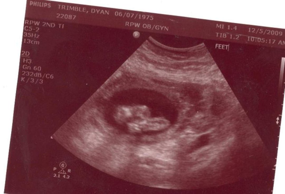 Dyan Trimble's album, Baby Trimble