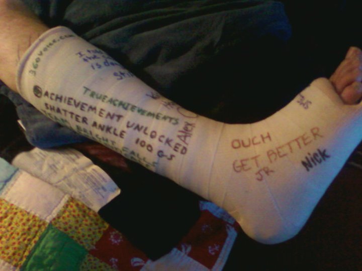 Curtis Springer's album, November, 12th 2010 Broken Ankle