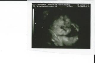Casey Board's album, Untitled Album