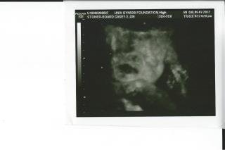 Casey Board's album, Untitled Album