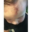 Kim Ellis' album, Nathan's "owie"
