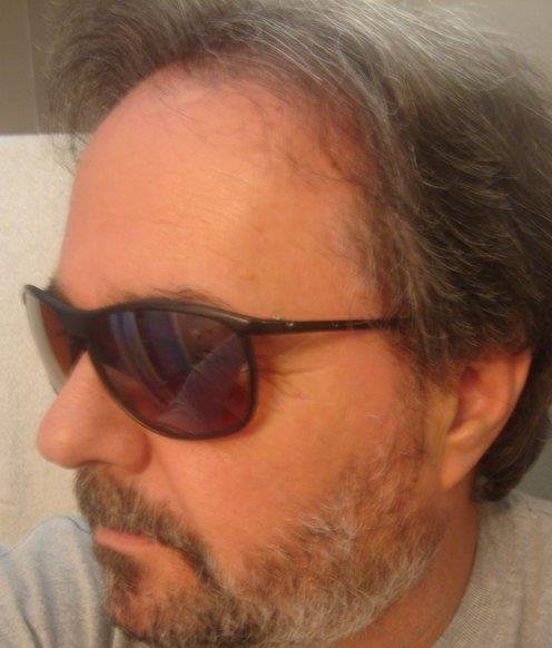 Robert Damia's album, Profile Pictures
