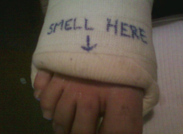 Curtis Springer's album, November, 12th 2010 Broken Ankle