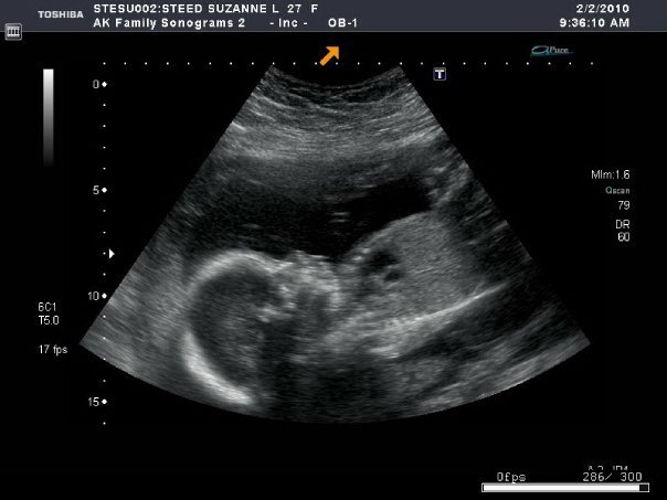 Ian Steed's album, my son to be