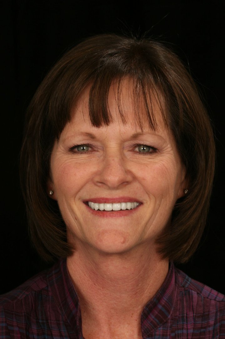 Beverly Vanover's album, Profile Pictures