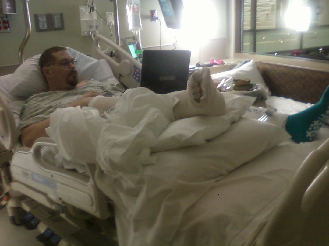 Curtis Springer's album, November, 12th 2010 Broken Ankle