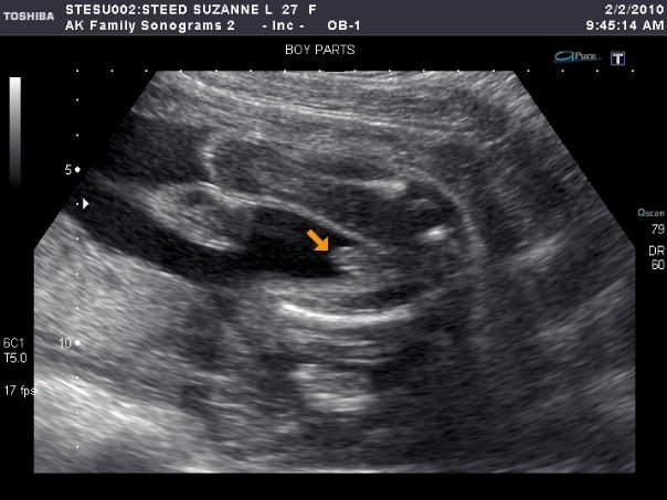 Ian Steed's album, my son to be