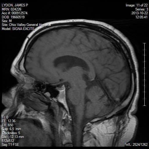 James Lydon's album, Profile Pictures