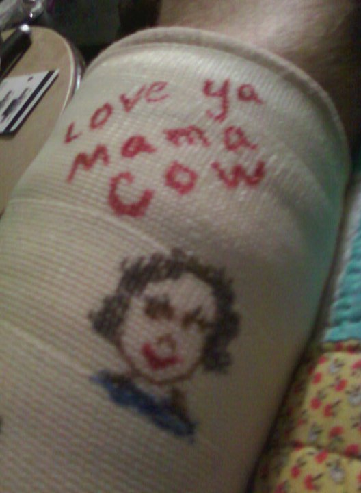 Curtis Springer's album, November, 12th 2010 Broken Ankle