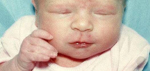 Candi Preston's album, Cover Photos