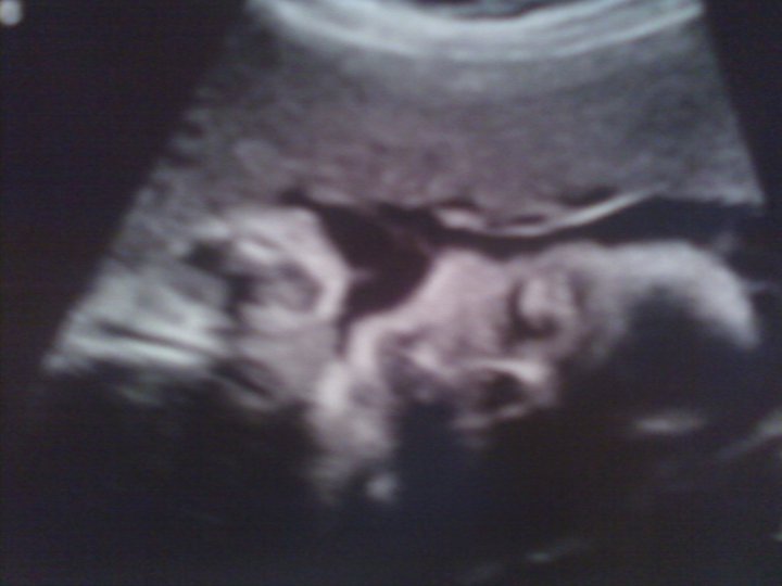 Ashley Brooks' album, Mobile Uploads