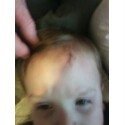Kim Ellis' album, Nathan's "owie"