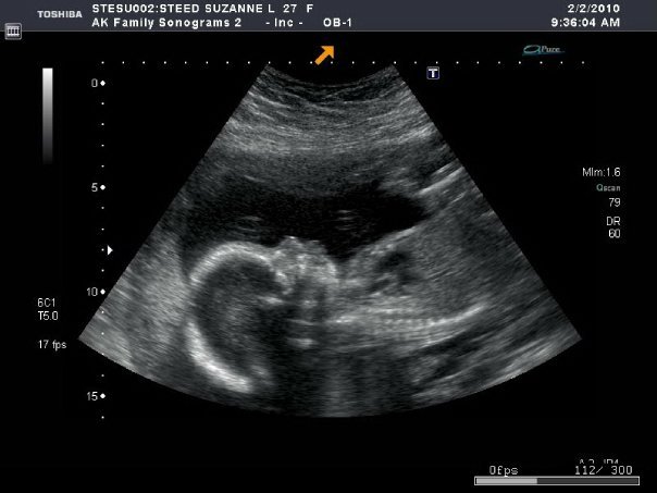 Ian Steed's album, my son to be