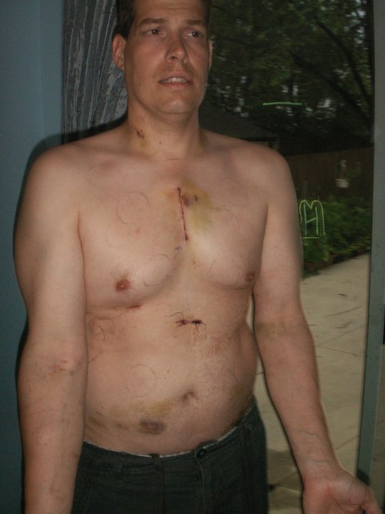 Christopher Sperk's album, Endocarditis