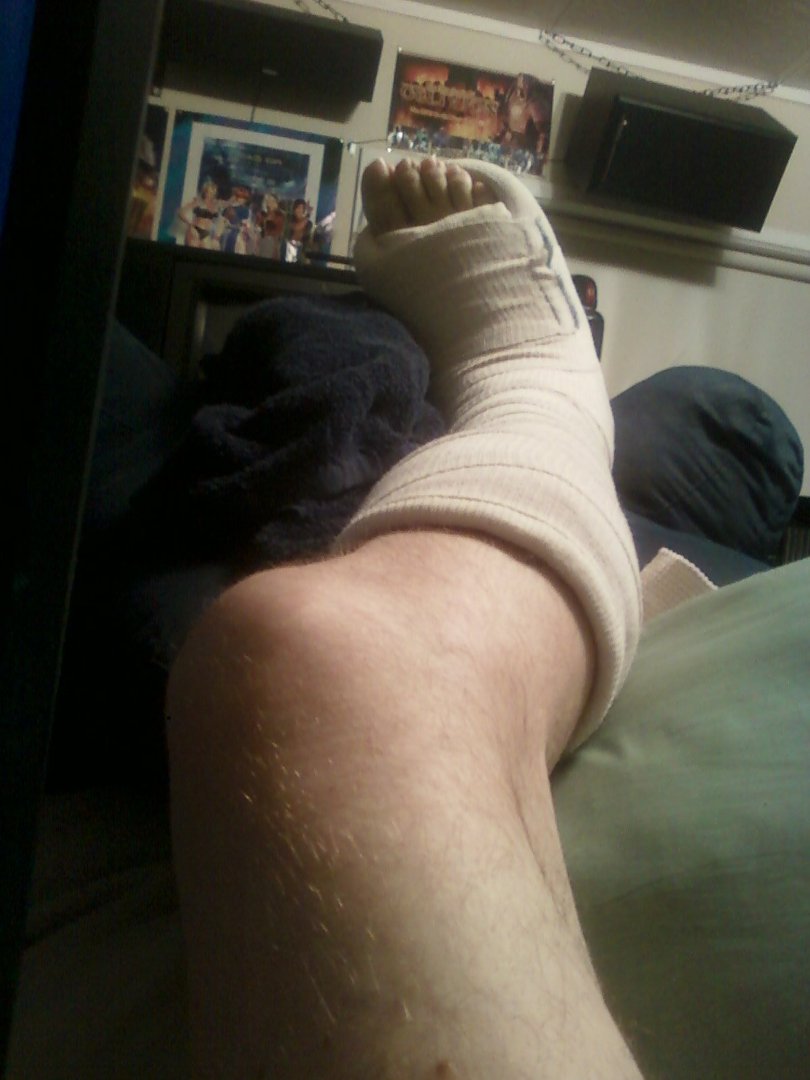 Curtis Springer's album, November, 12th 2010 Broken Ankle