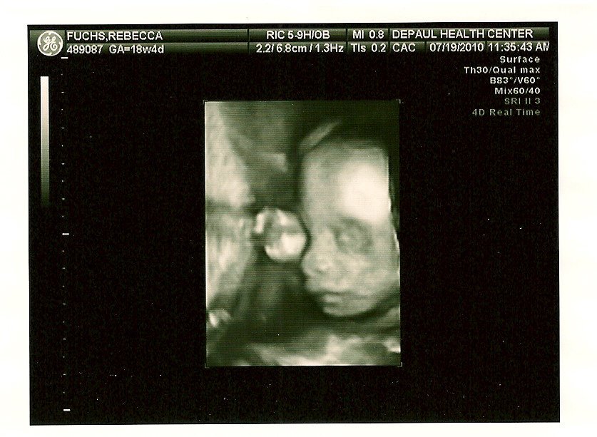 Barbara Tucker's album, landonAugust 2, 2011