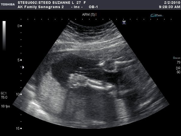 Ian Steed's album, my son to be