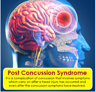 Post Concussion Syndrome