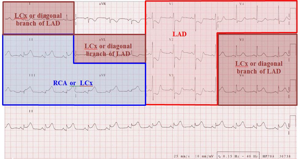 ECG regions