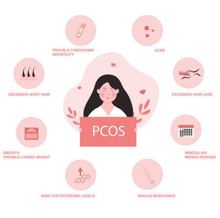 PCOS Symptoms
