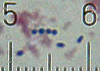Streptococcus thermophilus