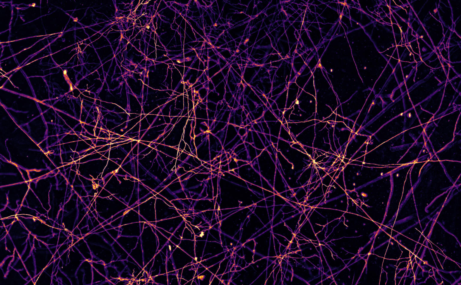 Image of the underground network that fungi have