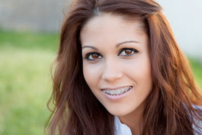 orthodontist braces fullerton