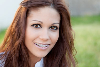 braces santa ana orthodontist