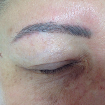 permanent-makeup-risks-and-complications