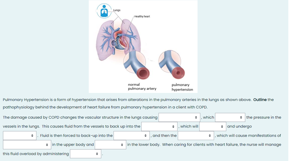 nurse describe the heart rate of the client with the ECG shown