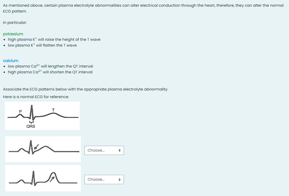cardiac arrest bradycardia arrhythmia Lungs Healthy heart normal pulmonary artery pulmonary hypertension