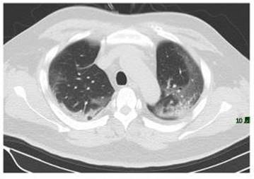 Serious matlab help needed!! I am trying to perform image segmentation