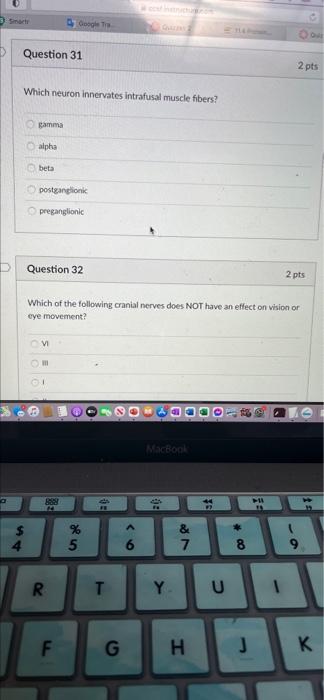 Question 30 Which part of the brain is the center for visceral
