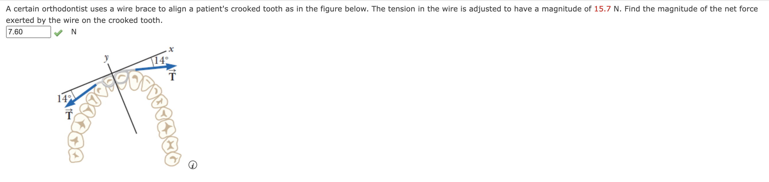  A certain orthodontist uses a wire brace to align a patient's