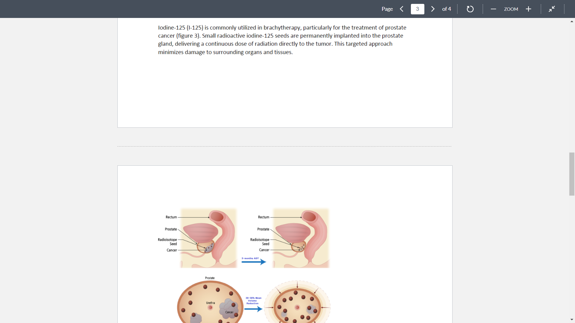 got those resources from, Ideally pubmed. > of4 D ZOOM + Page