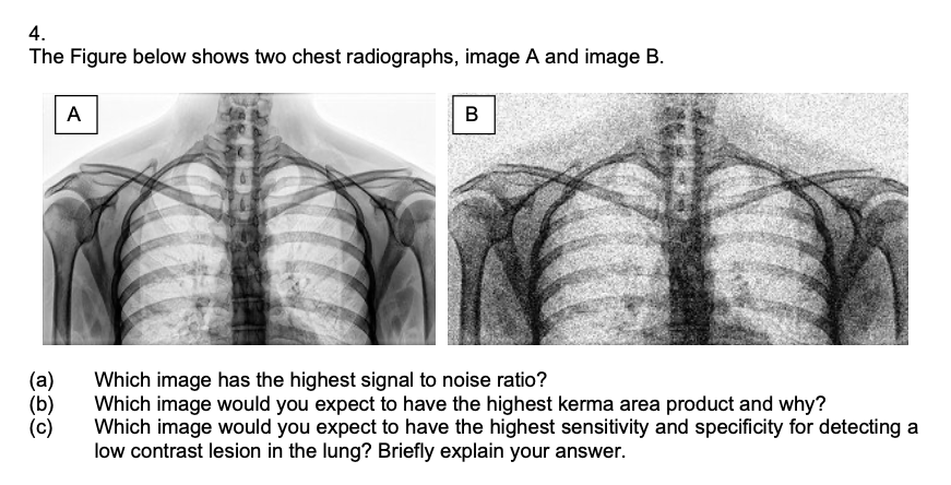 image B. {a} Which image has the highest signal to noise ratio?