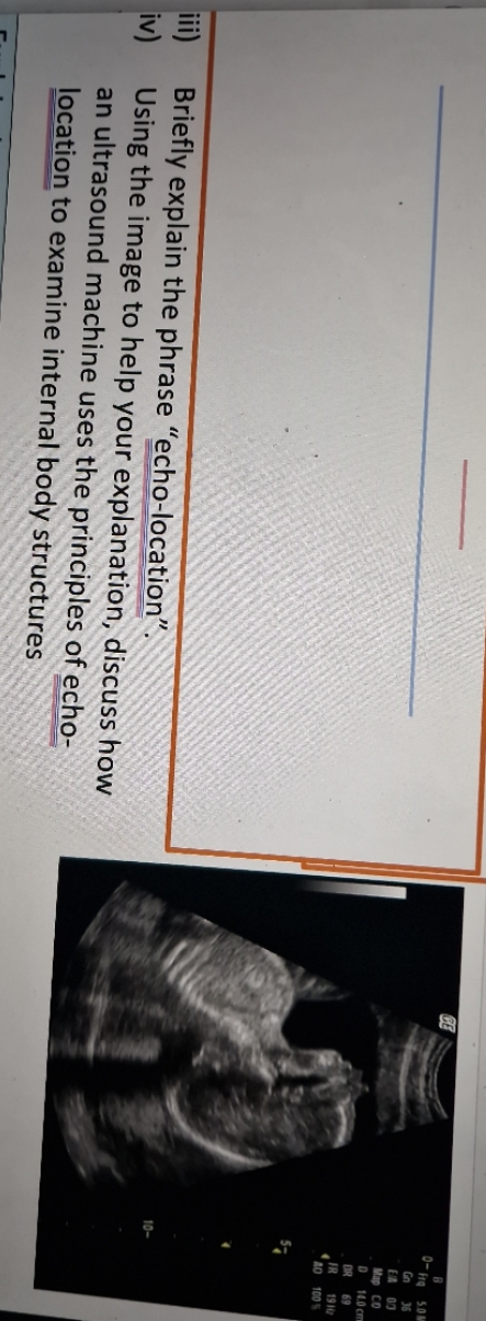 Thanks 14.0 cr 100 Briefly explain the phrase "echo-location" Using the image