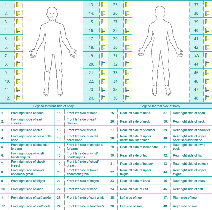 Direction:Indicate or place a check mark on diagram the areas of the