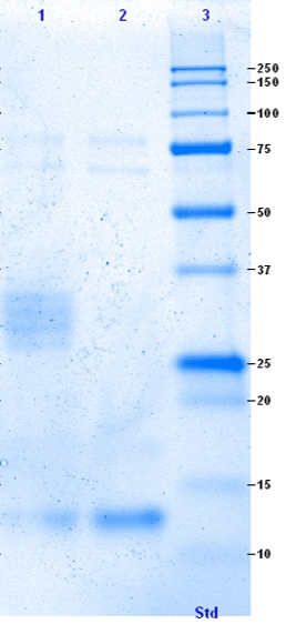 Hi can someone please help analyse this result from isolation and analysis