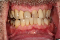 Smile Gallery