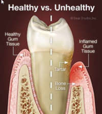 Oral Surgery Procedures Santa Barbara Dental Spa-1 Oral Surgery Procedures Santa Barbara Dental Spa-1